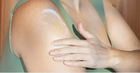 31 million people in the U.S. (including me) have eczema — here’s how to treat it